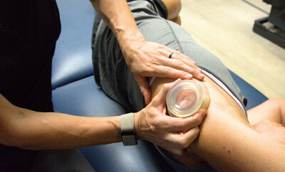 Cupping